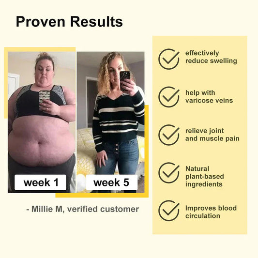 Bee Venom Lymphatic Drainage & Slimming Foot Patches(Pack of 10)